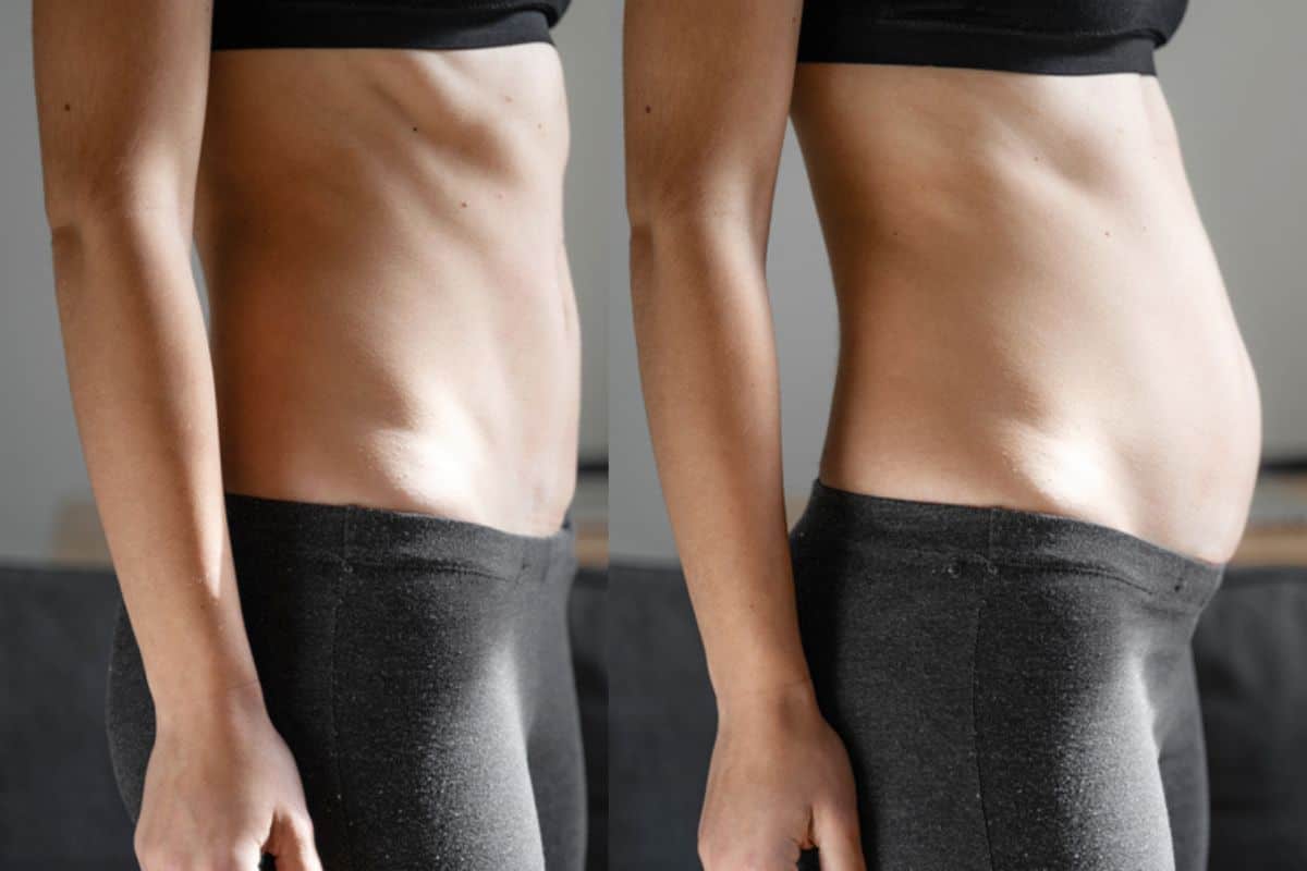How long does diastasis recti take to improve West Hendon?