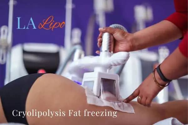 women getting fat freezing West Hendon