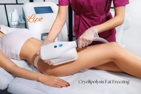 Woman receiving coolsculpting West Hendon treatment on her thighs