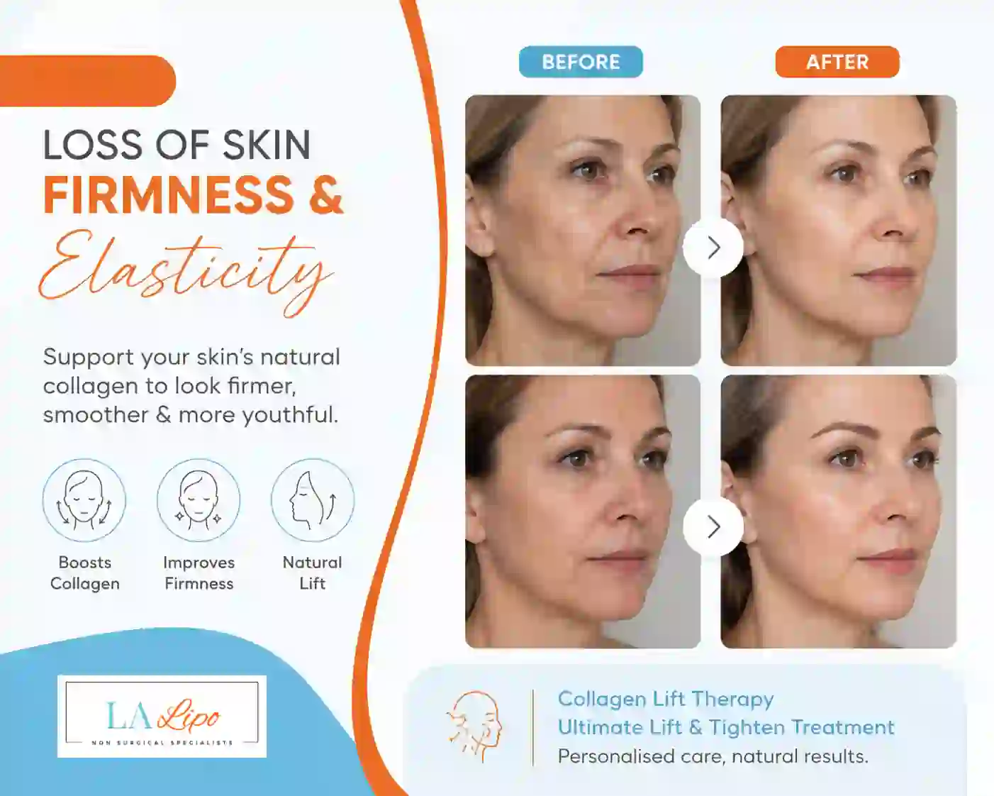 Sign #7: Loss of Skin Firmness and Elasticity West Hendon
