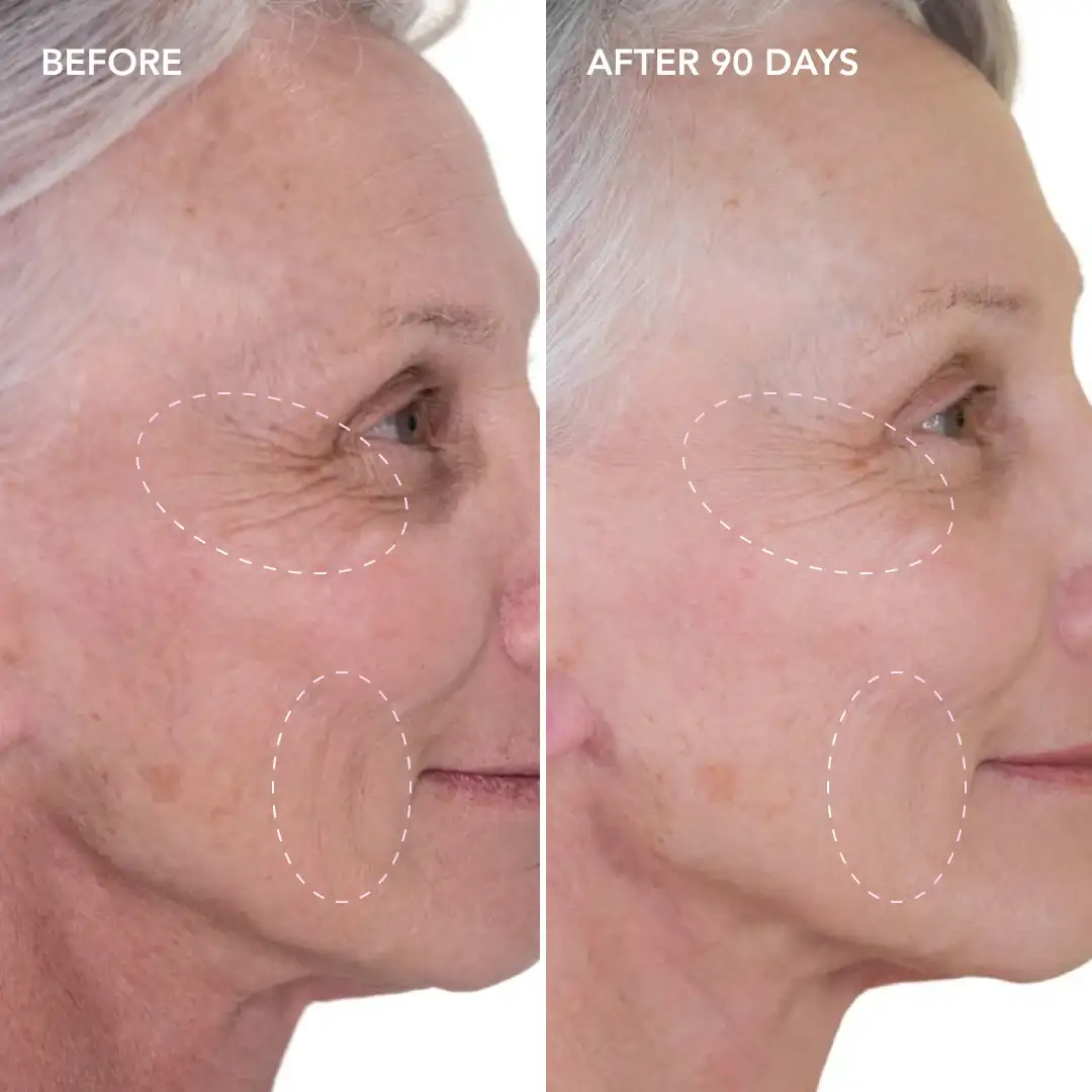 When will you see results West Hendon